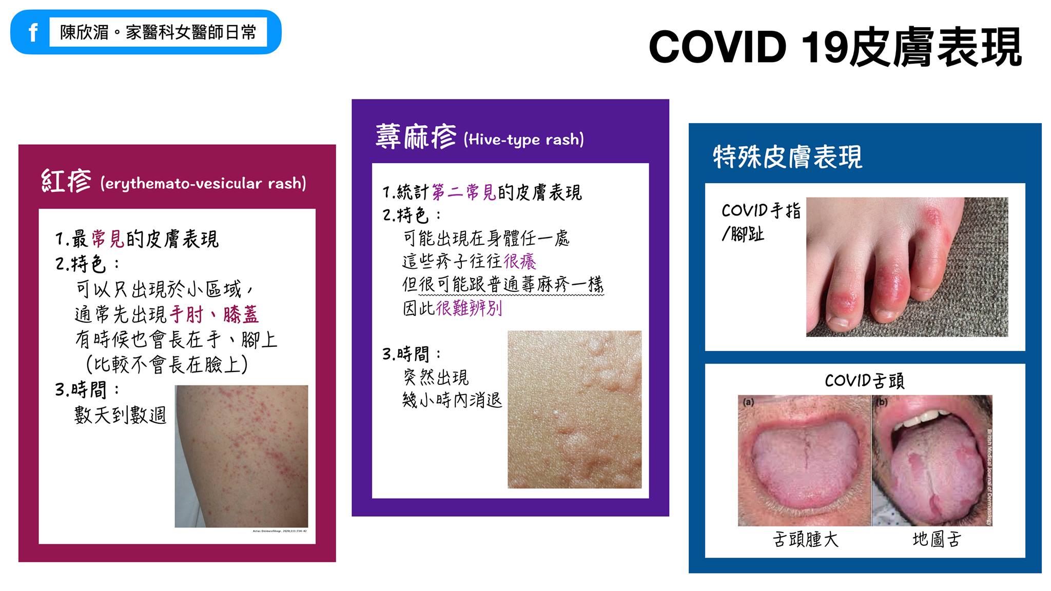 COVID-19的皮膚表現示意圖。