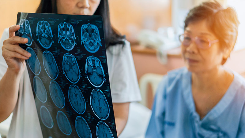 腦中風三大前兆　出現一種要馬上就醫