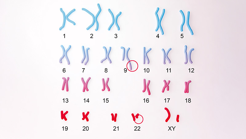 頻繁發燒、莫名瘀青　兒童癌症常見的五大症狀