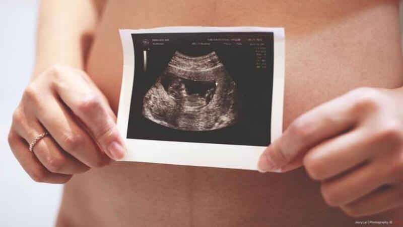 吃太多會害胎兒過敏？孕婦該不該全程服用葉酸