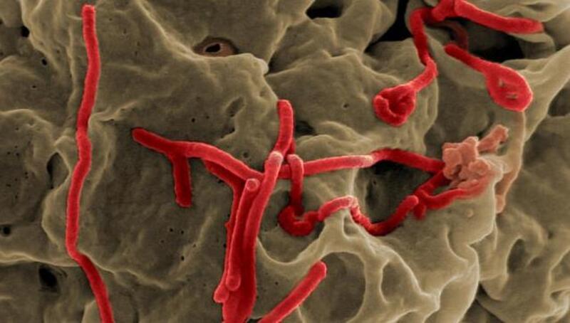 誰是真正把伊波拉病毒帶進美國的人？