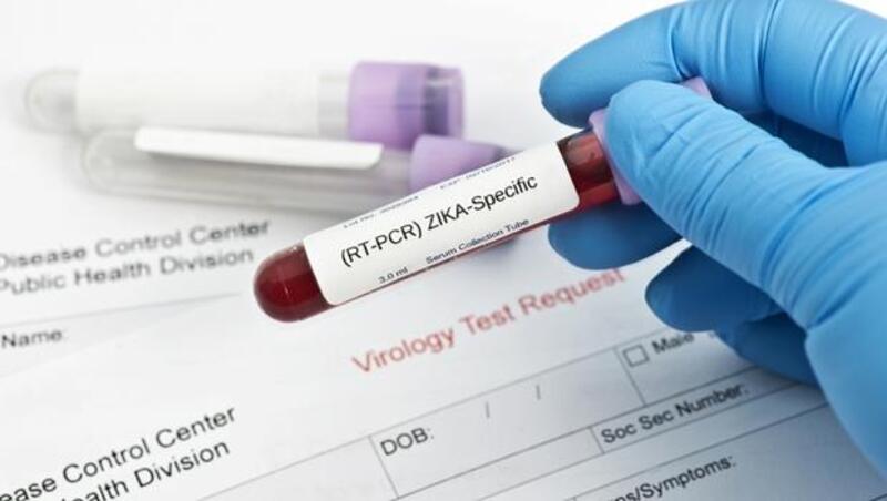 全球首例！日本成功開發出這款測試劑，不用再花1天時間，僅10分鐘就能驗出茲卡病毒