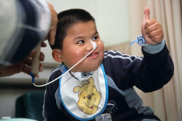 十年後的「大象男孩」